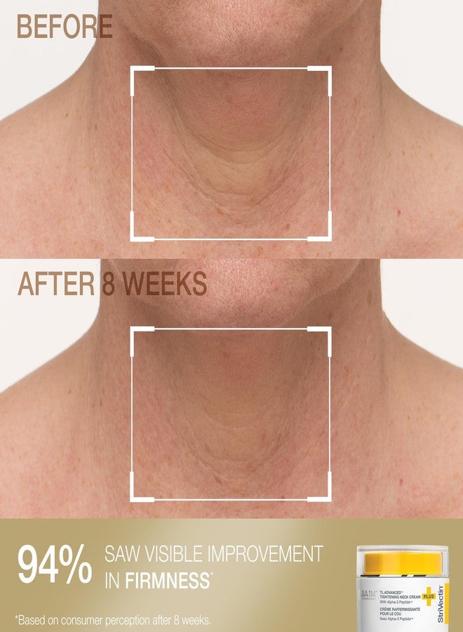 StriVectin Tighten & Smooth Neck Cream and Neck Serum Roller Anti-aging Skin Care 2-Piece Set, Smoothing Look of Wrinkles and Fine Lines, Improves Crepey Skin and Vertical Lines - Image 4
